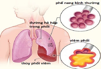 Triển khai Thông tư số 04/2016/TT-BYT, ngày 26/02/2016 của Bộ Y tế