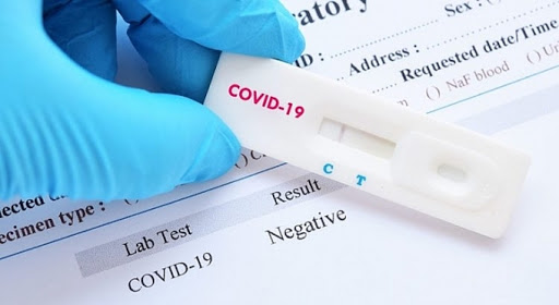 Vietnam can test 13,000 Covid-19 samples for the corona virus 2019 a day