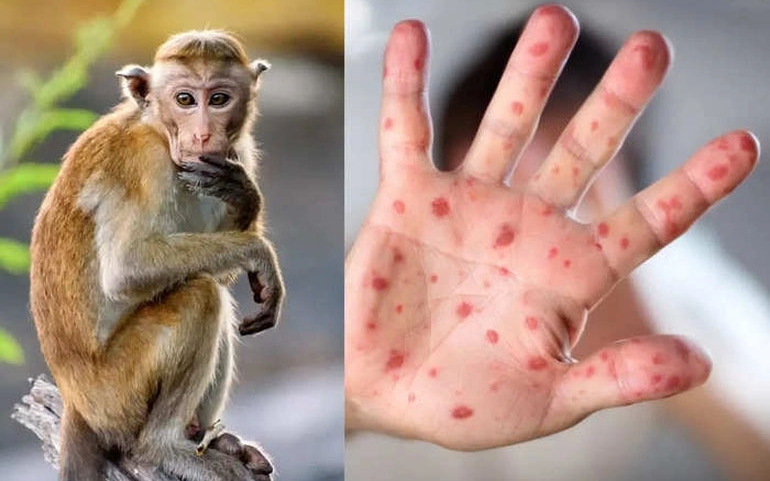 Chủ động phòng ngừa lây nhiễm bệnh Đậu mùa khỉ trên động vật