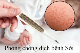 Tăng cường giám sát, phòng chống bệnh Sởi trên địa bàn